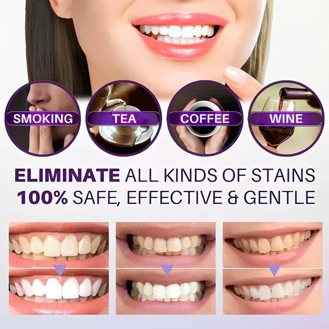 Hi Smile - Brighten Your Teeth Safely